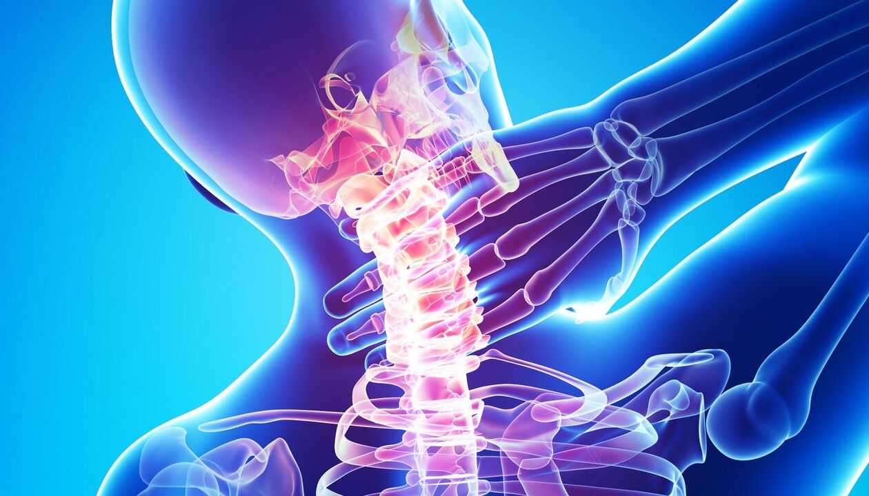 kaklo skausmas dėl osteochondrozės