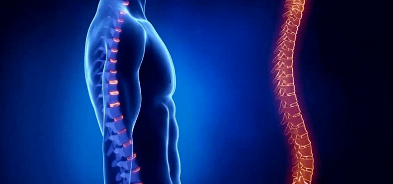 stuburo pažeidimai dėl osteochondrozės